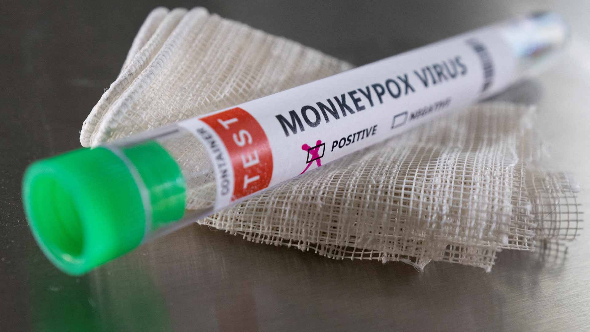 Image for the title: France confirms 51 monkeypox cases 