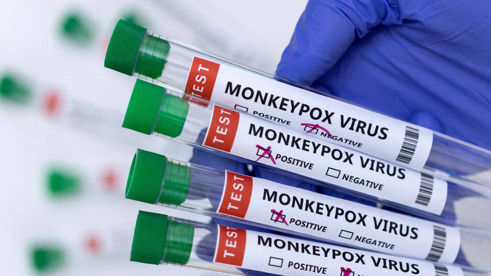 Image for the title: Africa CDC warns on vaccine hoarding amid monkeypox outbreak 