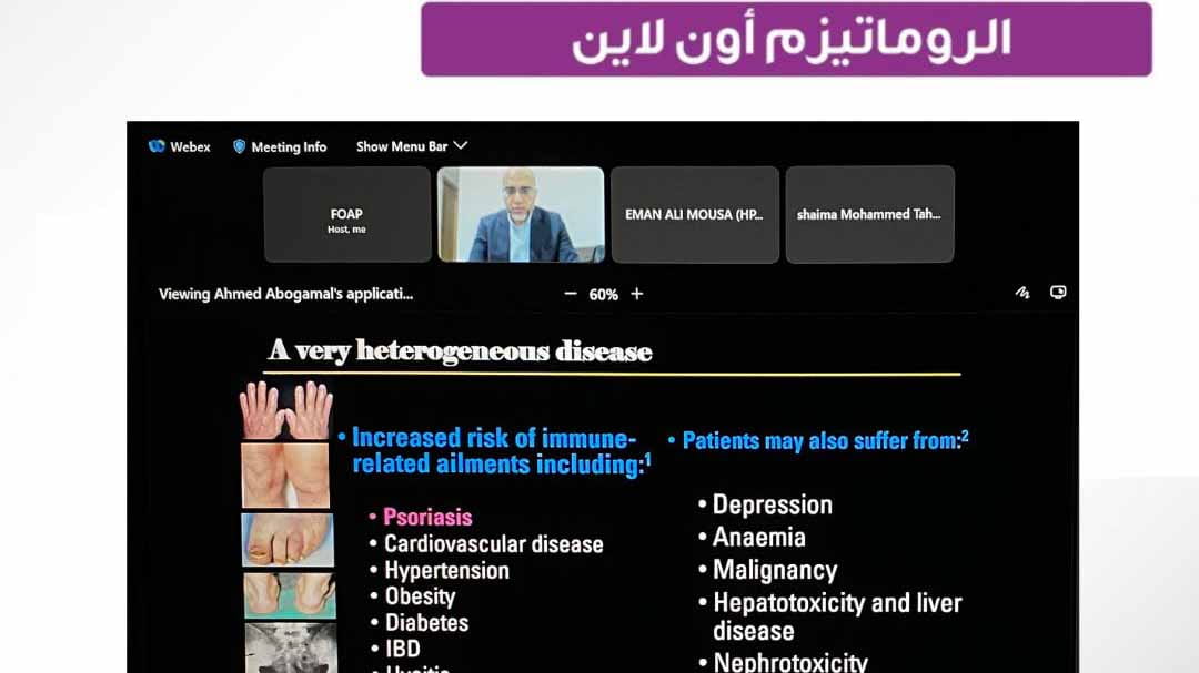 صورة بعنوان: بجلسة افتراضية.."التهاب المفاصل" تقدم نصائح صحية لمرضاها في رمضان  