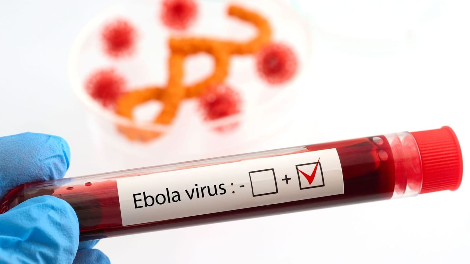 Image for the title: First Ebola patient in France recovers 